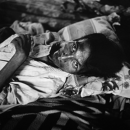 HIV Myanmar